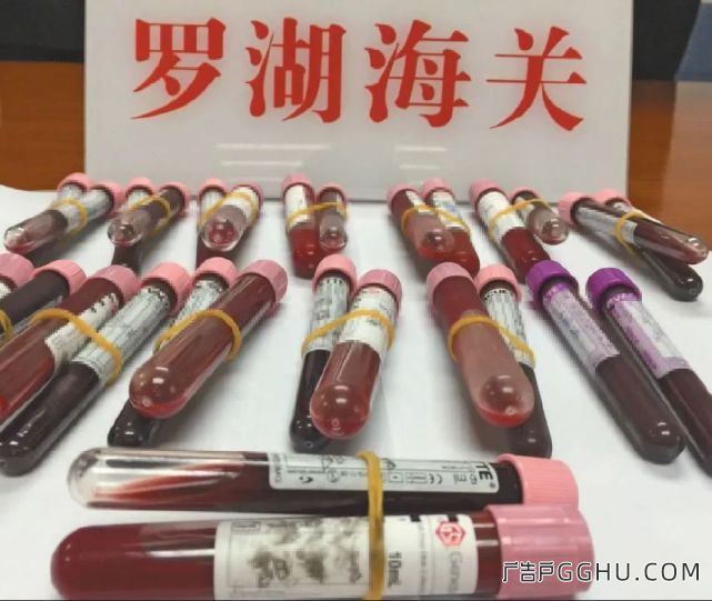 重庆医院打出定制胎儿广告牌被卫健委叫停